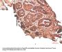 ATM Antibody