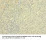 PTPRJ Antibody