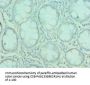 G3BP1 Antibody