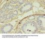 SKP2 Antibody