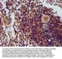 THOC5 Antibody