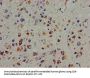 PTK2B Antibody