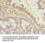 GALNT3 Antibody