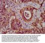 DSC3 Antibody