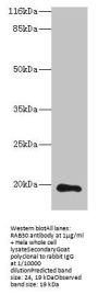 RAB30 Antibody