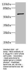 TBCE Antibody