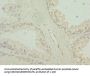 TBCE Antibody