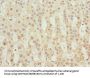 TBCE Antibody