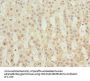 TBCE Antibody
