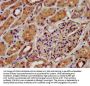 KCNJ8 Antibody