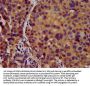 KCNJ8 Antibody
