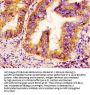 SCN9A Antibody