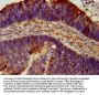 ASIC2 Antibody