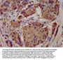 ASIC2 Antibody