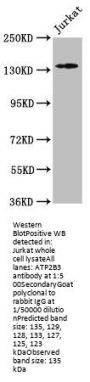 ATP2B3 Antibody