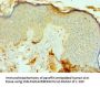 FAP Antibody