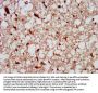 PTPN13 Antibody
