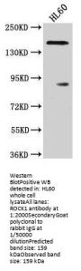 ROCK1 Antibody