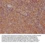 ROCK1 Antibody