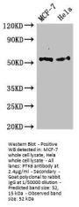 PTK6 Antibody