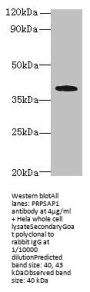 PRPSAP1 Antibody
