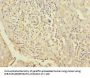 LPIN1 Antibody