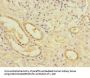 LPIN1 Antibody