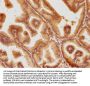 PSMD6 Antibody