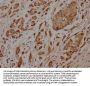 PCOLCE Antibody