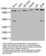 RABEP1 Antibody