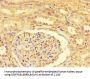 ZRSR2P1 Antibody