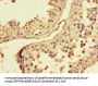 ZRSR2P1 Antibody