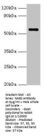 NAB2 Antibody