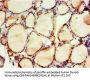 NAB2 Antibody