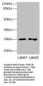 RAB11B Antibody