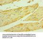HSPB2 Antibody