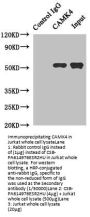 CAMK4 Antibody