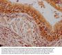 CA9 Antibody