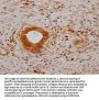 CA9 Antibody