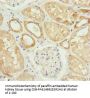 HADH Antibody