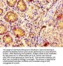 EPS8 Antibody