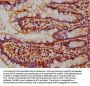 NAIP Antibody
