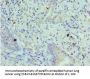 BIK Antibody