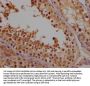 NFATC2 Antibody