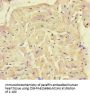 SQSTM1 Antibody