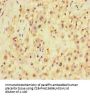 SQSTM1 Antibody