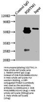 SQSTM1 Antibody