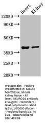 NEUROD1 Antibody