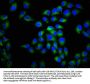 CACNA1C Antibody
