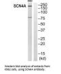 SCN4A Antibody